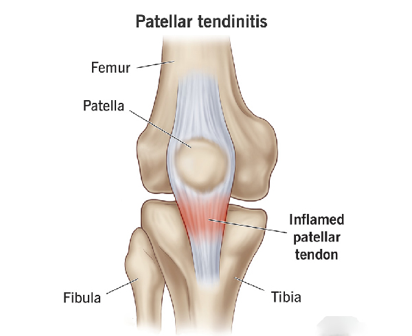 Knee at GB Clinics