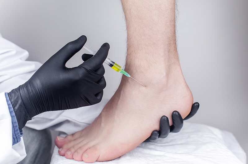 Guided Hylauronic Acid Injection (Gel Injection) at GB Clinics