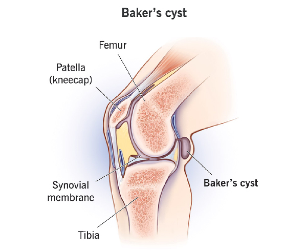 Knee at GB Clinics